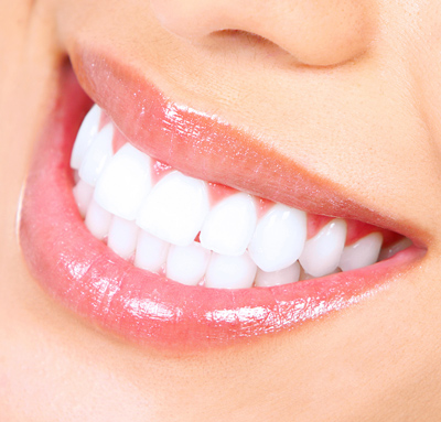 Dental implants at A·Dent