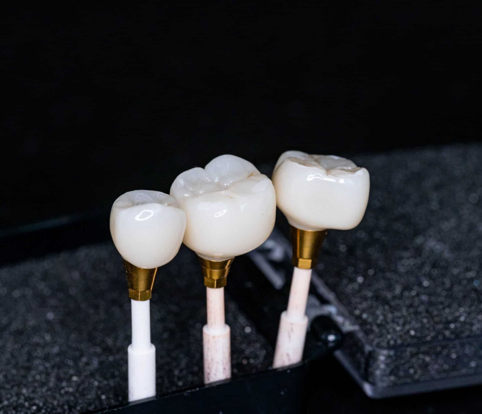 In-house dental laboratory