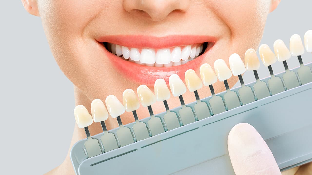 Composite bonding